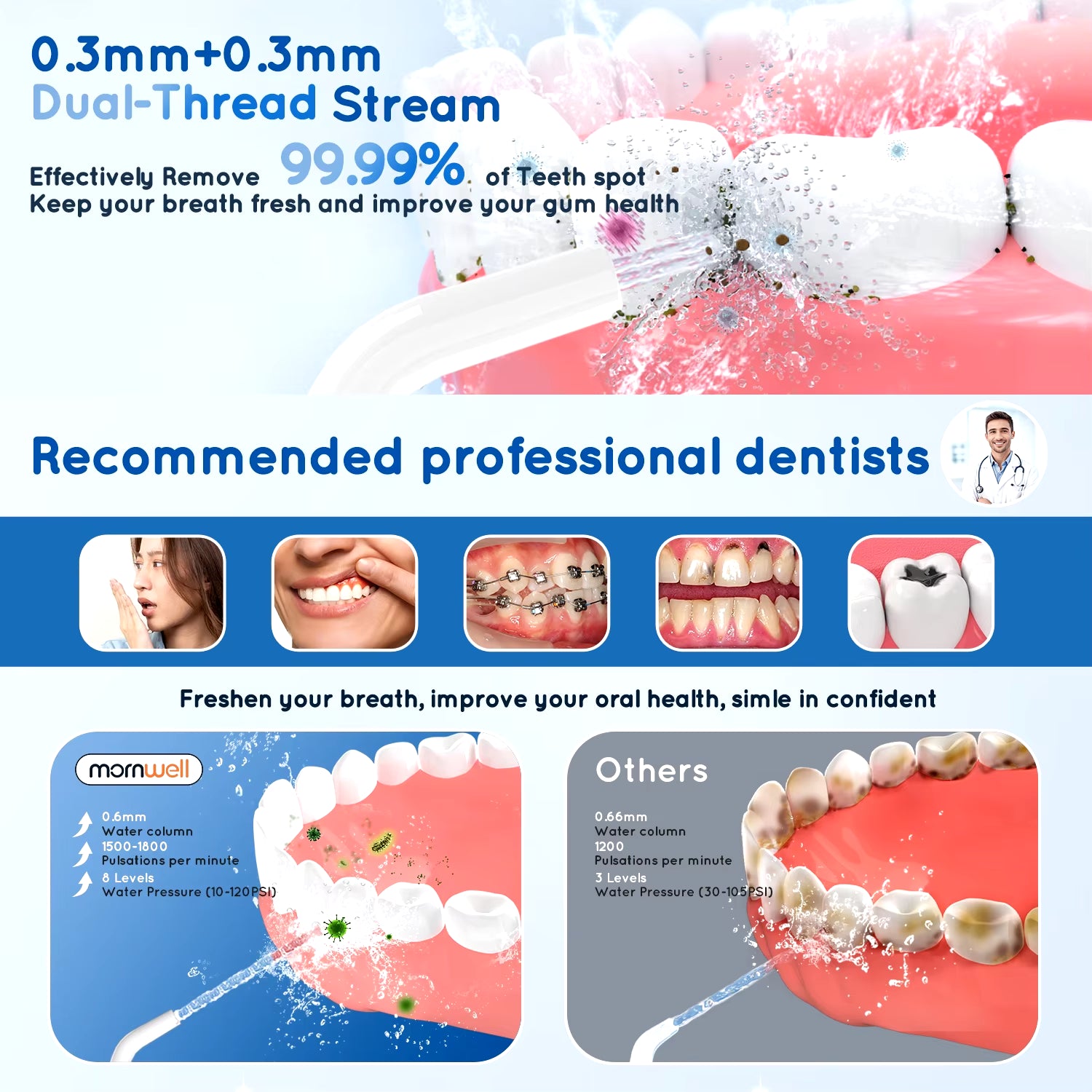 Portable Oral Irrigator – USB Rechargeable Dental Water Flosser with 4 Jet Tips & 3 Modes
